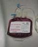 Whole Umbilical Cord Blood
